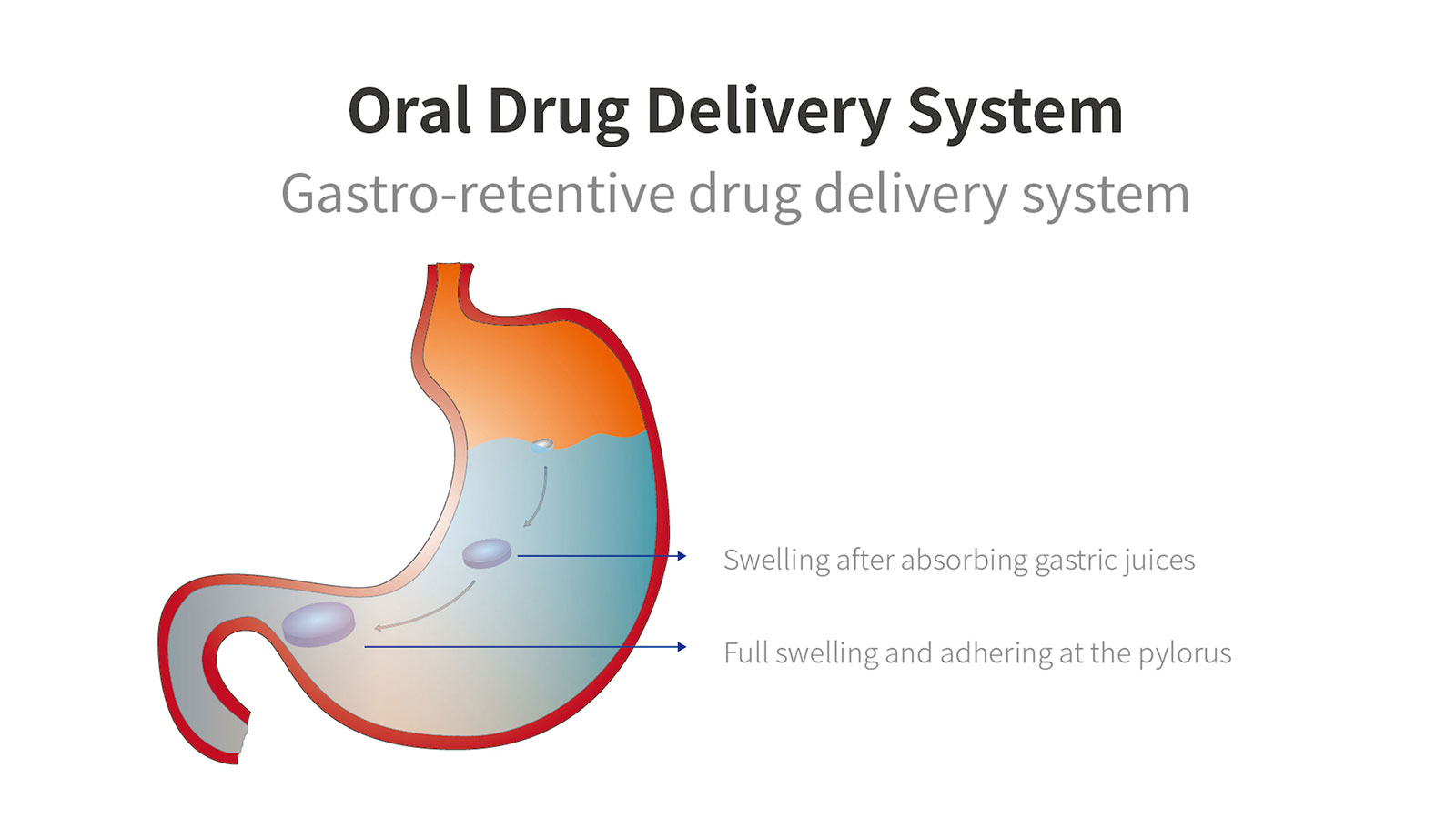 Gastro-retentive drug delivery system